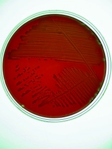 Plate showing colonies od Escherichia coli. Photo: Prevtec Microbia
